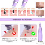 2026 Pore Vacuum, USB Rechargeable Blackhead Remover Vacuum,3 Levels Adjustable Pore Vacuum Blackhead Remover, with 5 Suction Power,6 Probes,Face Vacuum Pore Cleanser for Women & Men-White