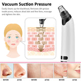 2026 Pore Vacuum, USB Rechargeable Blackhead Remover Vacuum,3 Levels Adjustable Pore Vacuum Blackhead Remover, with 5 Suction Power,6 Probes,Face Vacuum Pore Cleanser for Women & Men-White